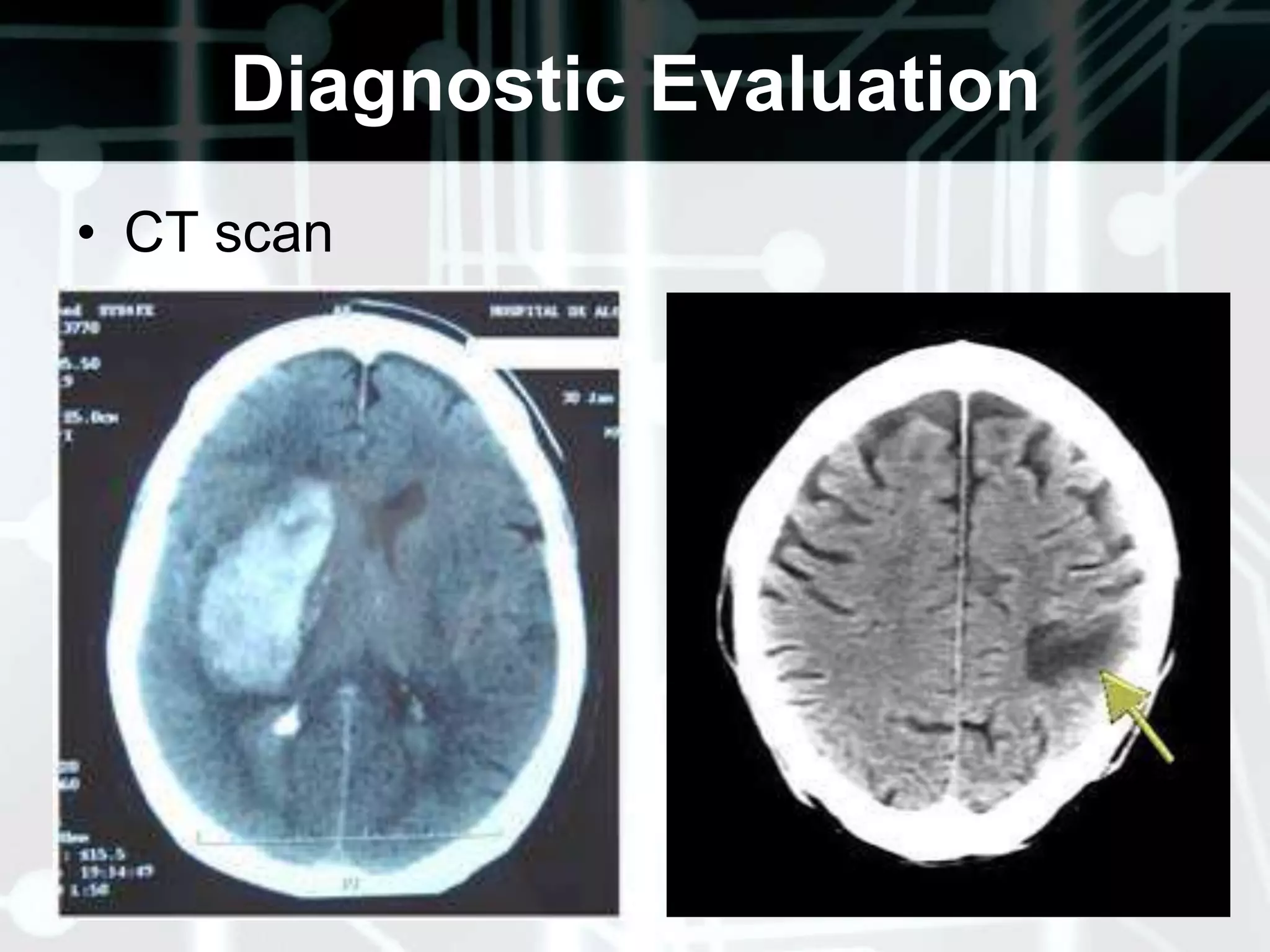II. Examining the Cranial Nerves 