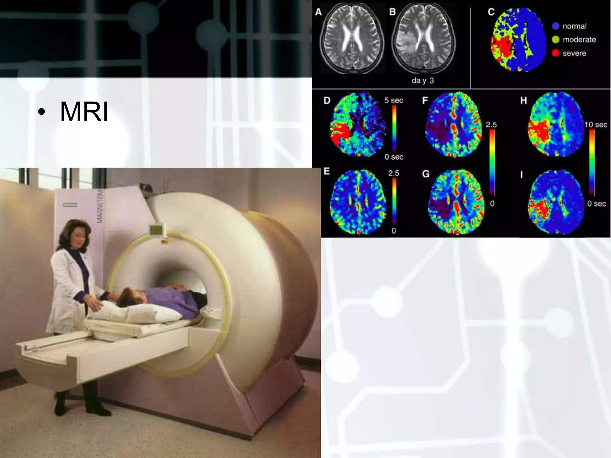 III. Examining the Motor SystemAssess muscle size, tone, and strength, coordination, and balanceNote for rigidity, spasticity and flaccidity