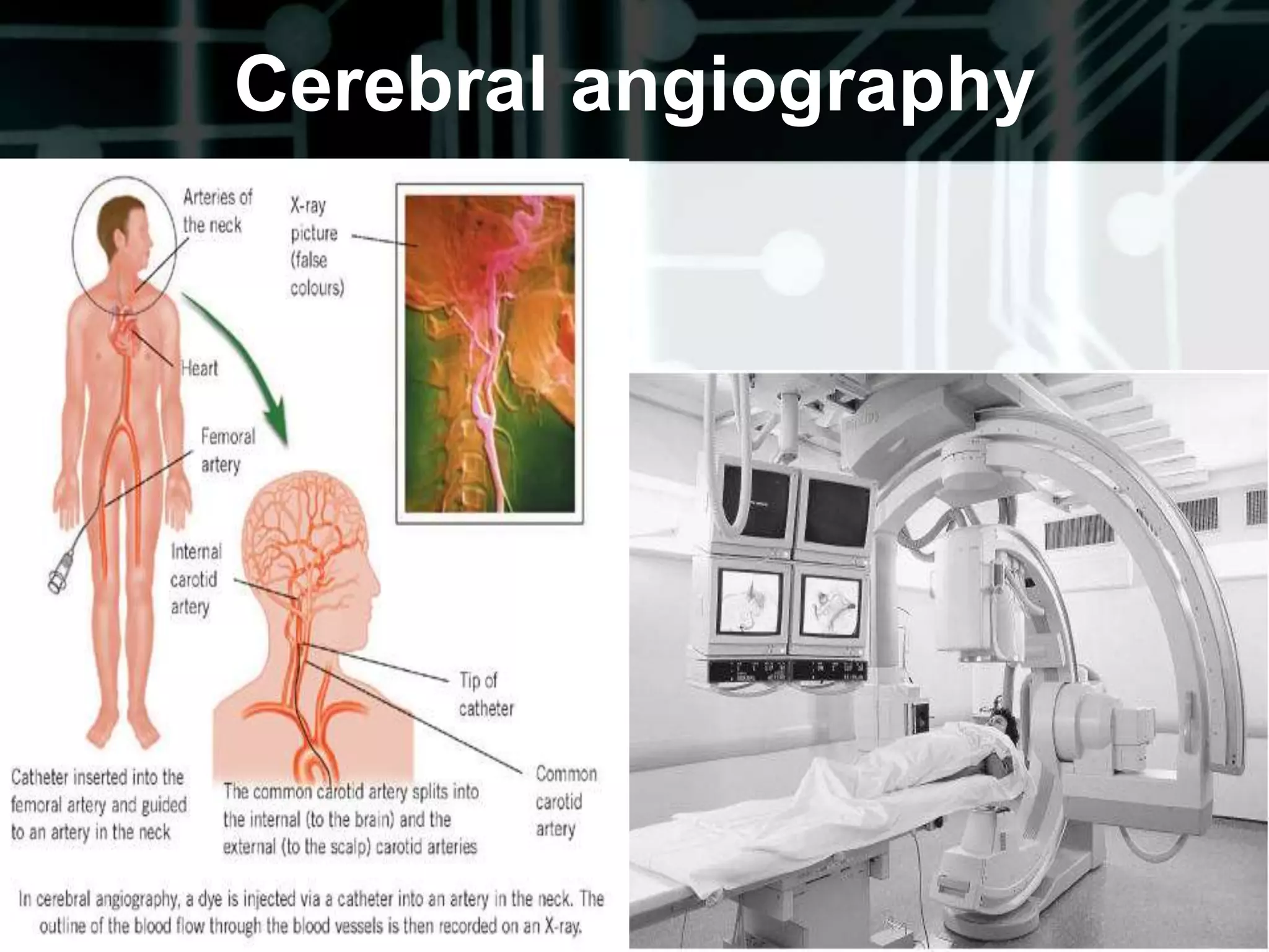 Muscle Strength Grading	0 – No contraction1 – Slight contraction, no movement2 – Full range of motion without gravity3 – Full range of motion with gravity4 – Full range of motion , some resistance5 – Full range of motion, full resistance