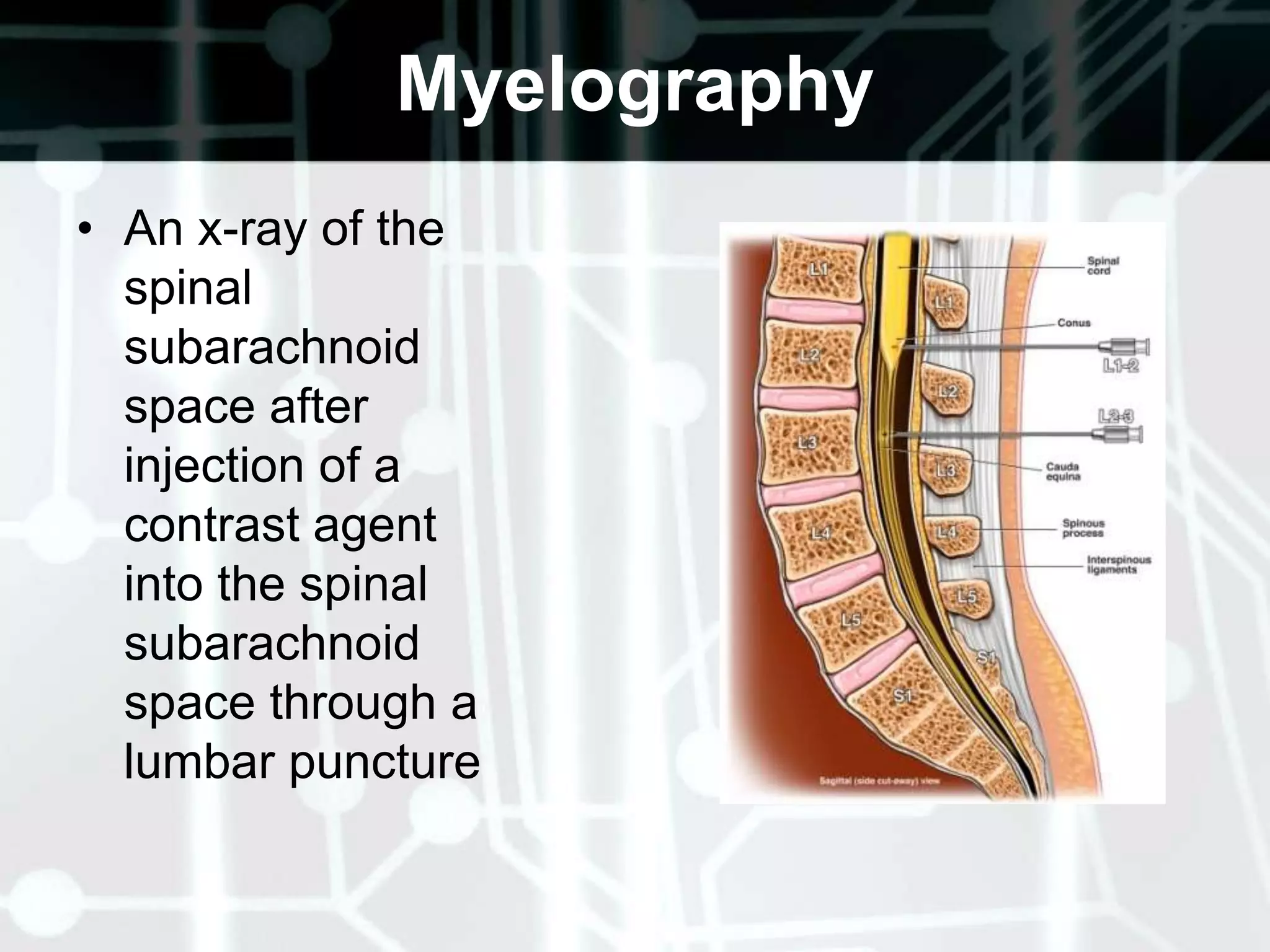 Balance and CoordinationRapid, alternating movementsPoint-to-point testing Ataxia- incoordination of voluntary muscle action Romberg test