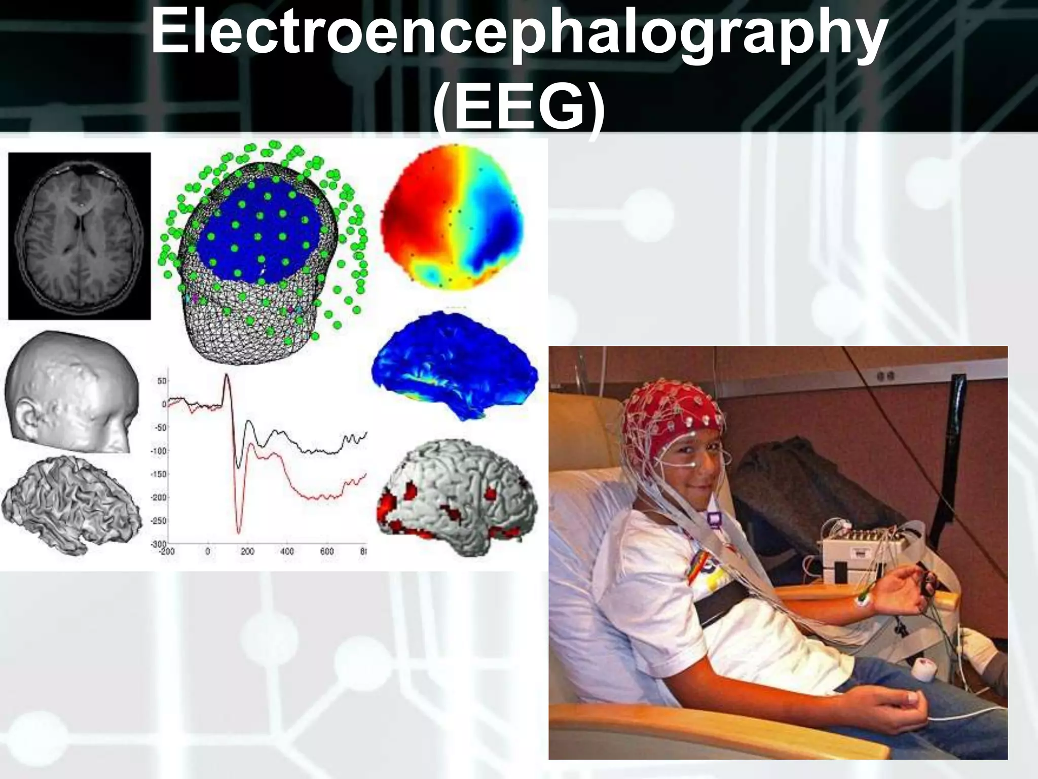 Reflexes Biceps reflexTriceps reflexBrachioradialis reflexPatellar reflexAnkle reflexSuperficial reflexesCorneal Abdominal reflexesGagCremastericPlantarperianal