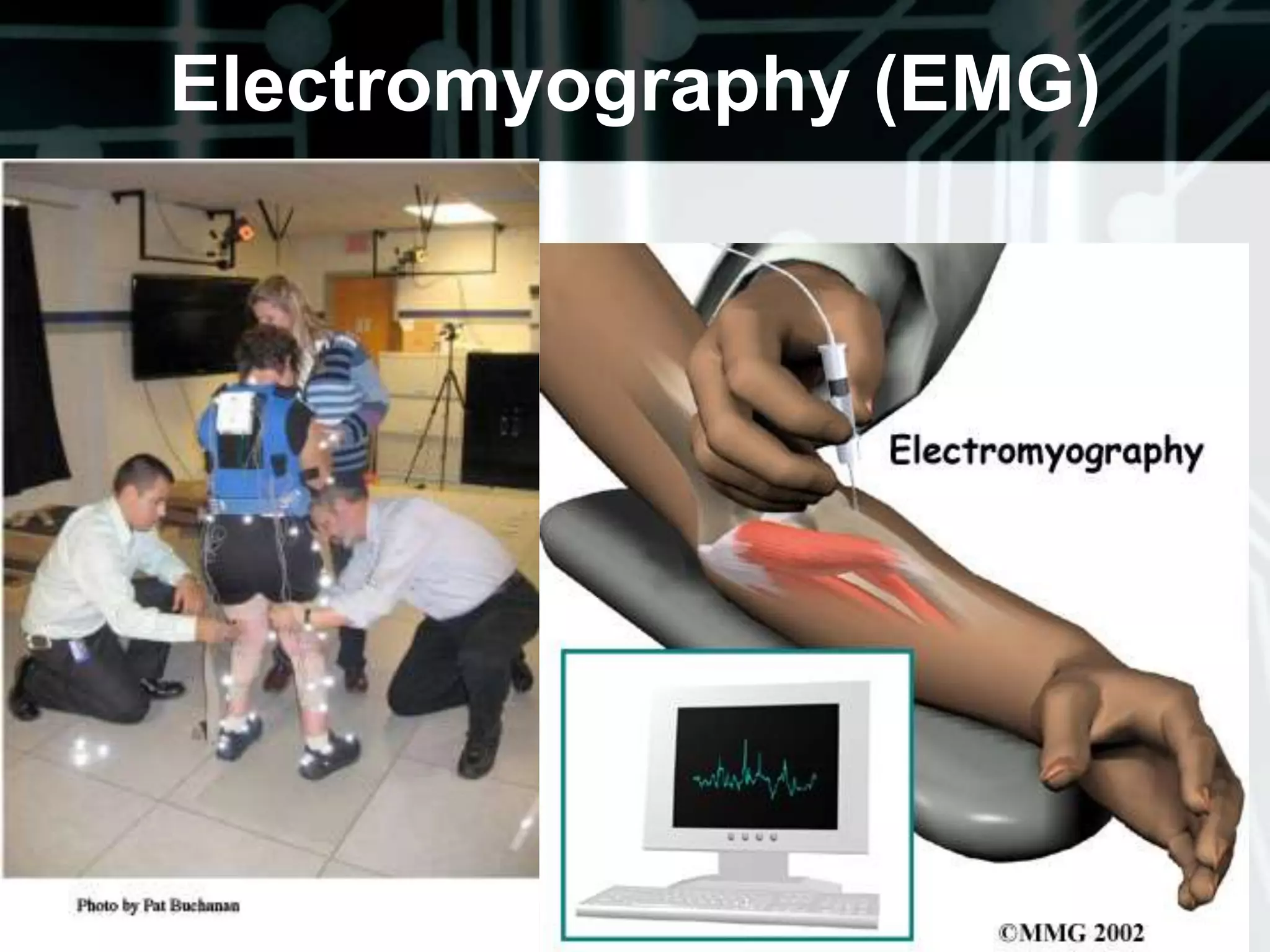 V. Sensory ExaminationThe sensory examination is largely subjective and requires the cooperation of the patient. 