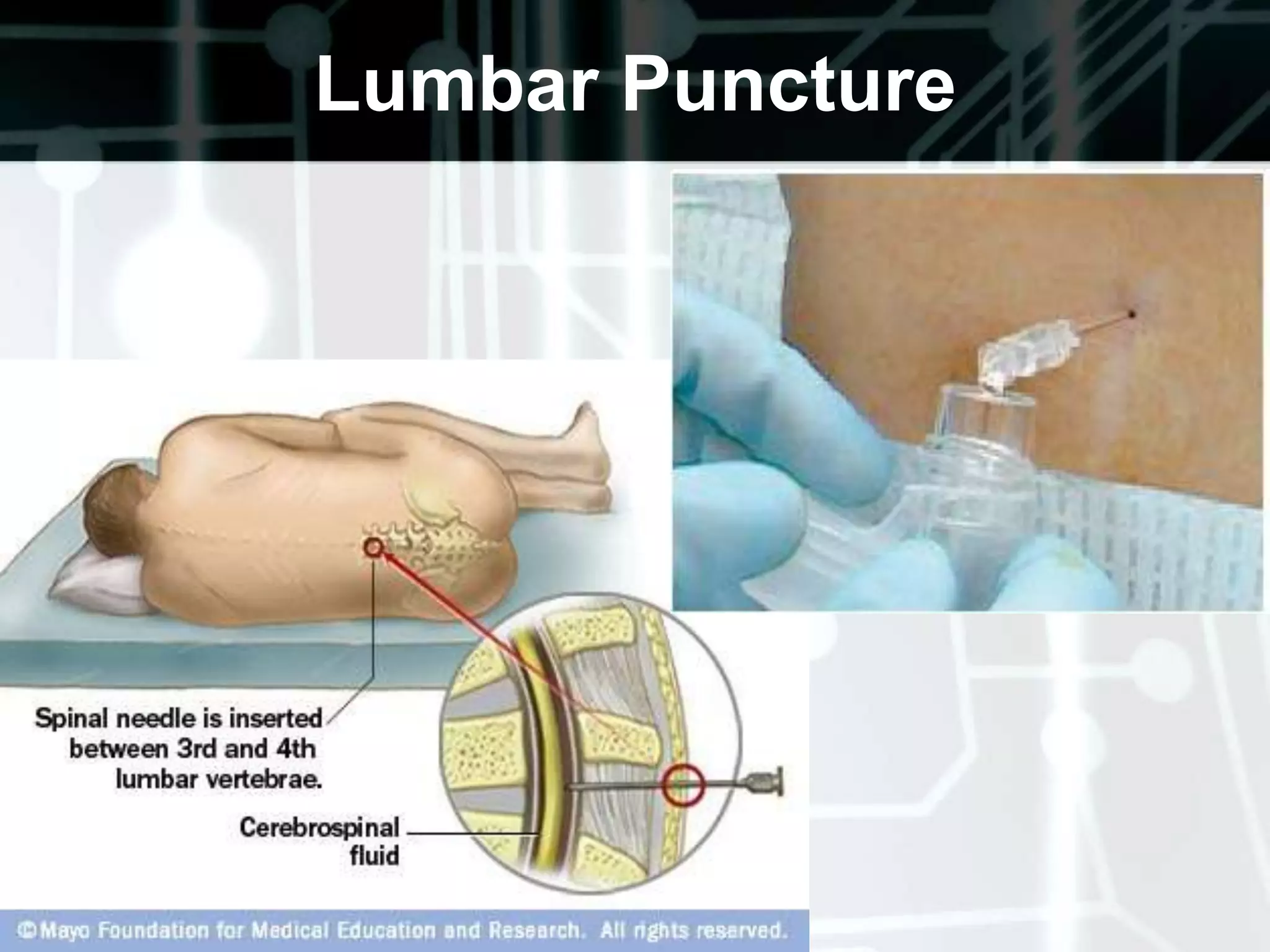 Assessment of the sensory system involves: Tactile sensation Superficial pain Vibration Integration of sensation ProprioceptionStereognosis