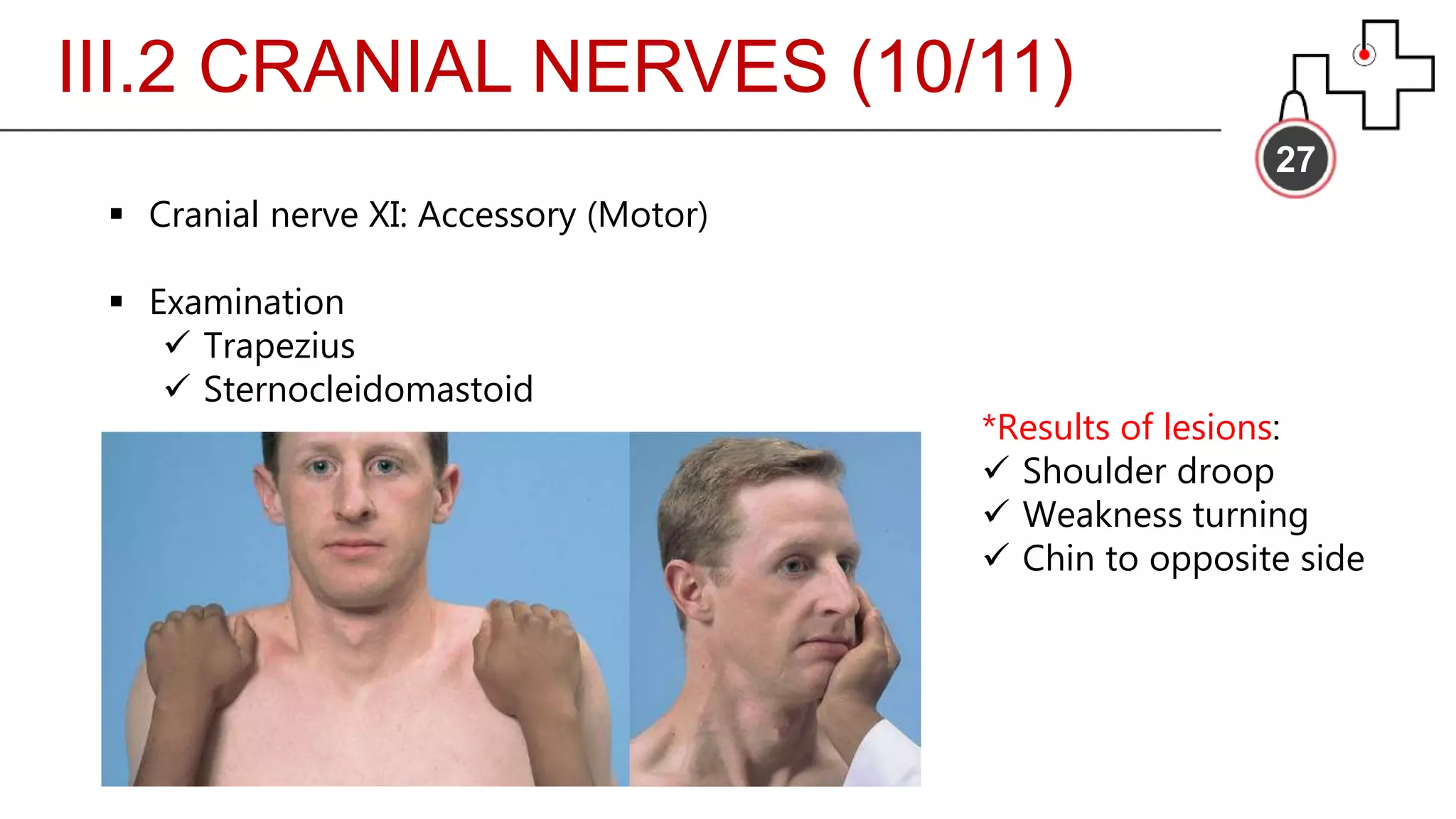 III.2 CRANIAL NERVES (10/11)
27
 Cranial nerve XI: Accessory (Motor)
 Examination
 Trapezius
 Sternocleidomastoid
*Results of lesions:
 Shoulder droop
 Weakness turning
 Chin to opposite side
 