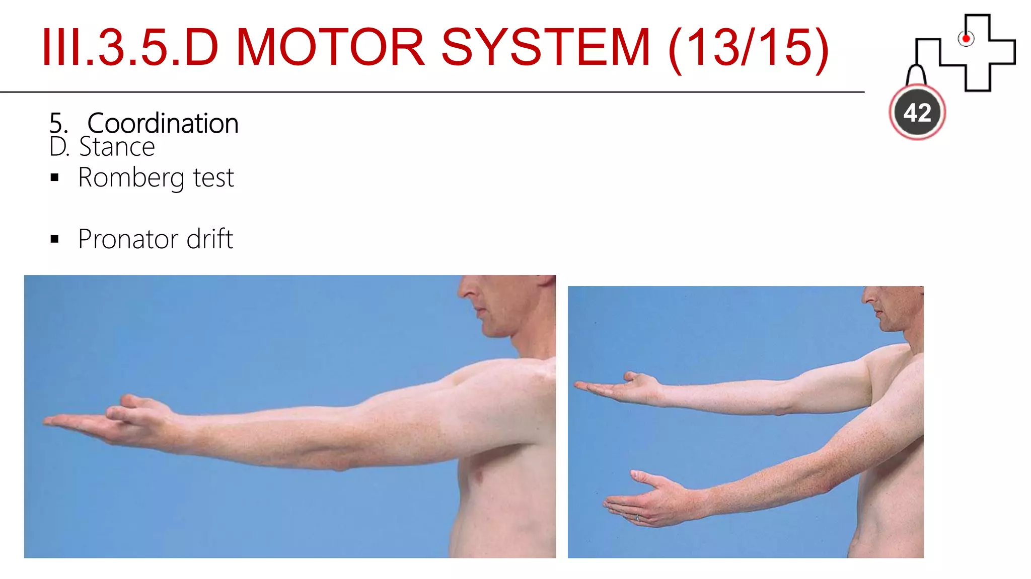 III.3.5.D MOTOR SYSTEM (13/15)
425. Coordination
D. Stance
 Romberg test
 Pronator drift
 