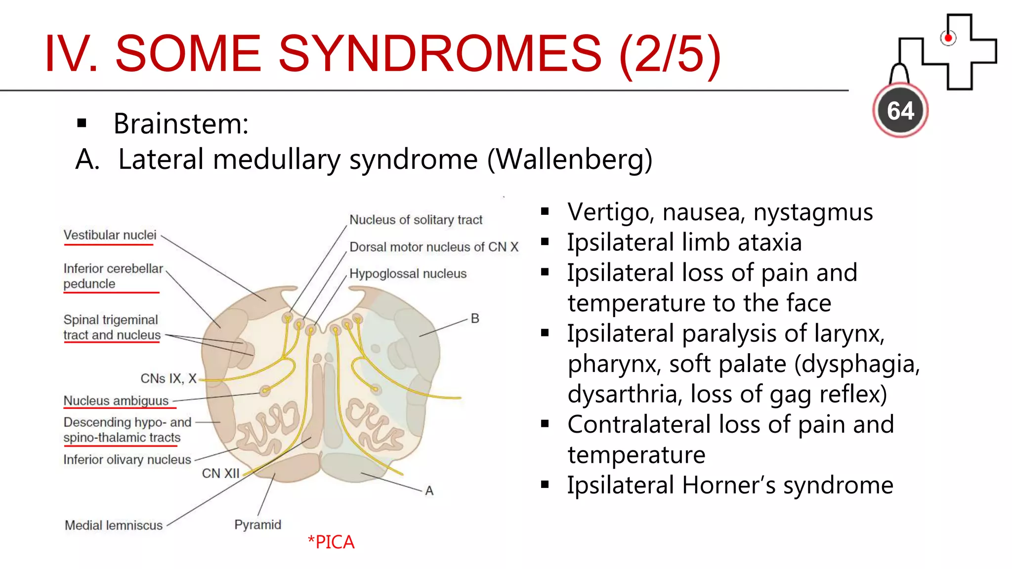 IV. SOME SYNDROMES (2/5)
64
 Brainstem:
A. Lateral medullary syndrome (Wallenberg)
 Vertigo, nausea, nystagmus
 Ipsilateral limb ataxia
 Ipsilateral loss of pain and
temperature to the face
 Ipsilateral paralysis of larynx,
pharynx, soft palate (dysphagia,
dysarthria, loss of gag reflex)
 Contralateral loss of pain and
temperature
 Ipsilateral Horner’s syndrome
*PICA
 