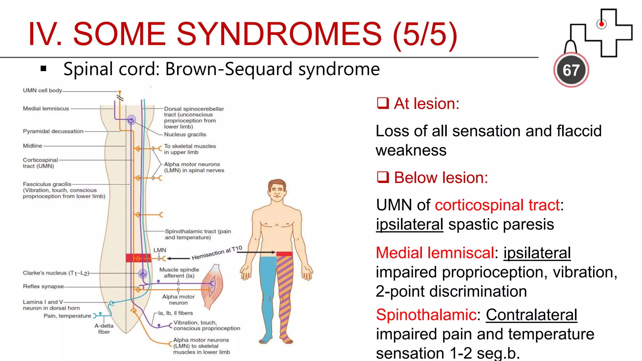 IV. SOME SYNDROMES (5/5)
67 Spinal cord: Brown-Sequard syndrome
 At lesion:
Loss of all sensation and flaccid
weakness
 Below lesion:
UMN of corticospinal tract:
ipsilateral spastic paresis
Medial lemniscal: ipsilateral
impaired proprioception, vibration,
2-point discrimination
Spinothalamic: Contralateral
impaired pain and temperature
sensation 1-2 seg.b.
 