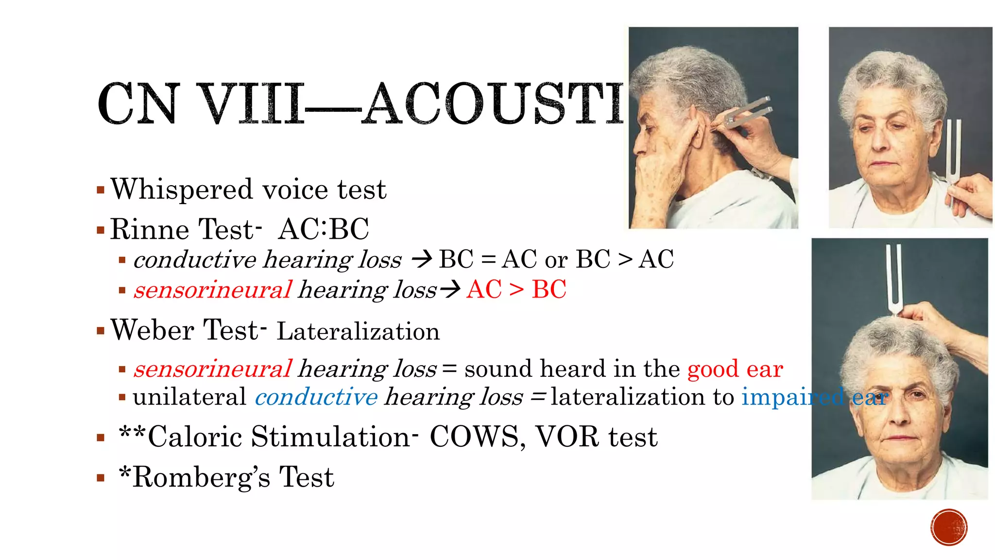 Whispered voice test
Rinne Test- AC:BC
 conductive hearing loss  BC = AC or BC > AC
 sensorineural hearing loss AC > BC
Weber Test- Lateralization
 sensorineural hearing loss = sound heard in the good ear
 unilateral conductive hearing loss = lateralization to impaired ear
 **Caloric Stimulation- COWS, VOR test
 *Romberg’s Test
 