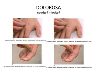 DOLOROSA
neurite? miosite?
 