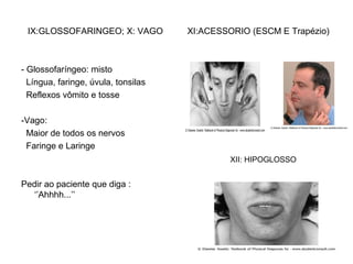 IX:GLOSSOFARINGEO; X: VAGO
- Glossofaríngeo: misto
Língua, faringe, úvula, tonsilas
Reflexos vômito e tosse
-Vago:
Maior de todos os nervos
Faringe e Laringe
Pedir ao paciente que diga :
‘’Ahhhh...’’
XI:ACESSORIO (ESCM E Trapézio)
XII: HIPOGLOSSO
 