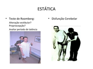 ESTÁTICA
• Teste de Roomberg:
Alteração vestibular?
Propriocepção?
Avaliar período de latência
• Disfunção Cerebelar
 