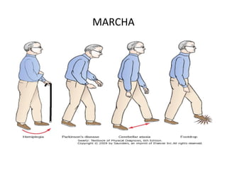 MARCHA
 