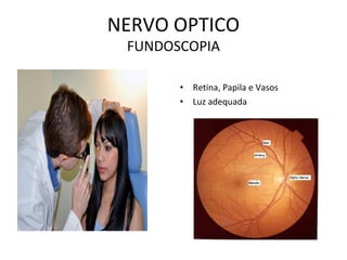 NERVO OPTICO
FUNDOSCOPIA
• Retina, Papila e Vasos
• Luz adequada
 