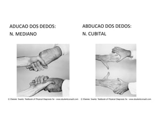ADUCAO DOS DEDOS:
N. MEDIANO
ABDUCAO DOS DEDOS:
N. CUBITAL
 