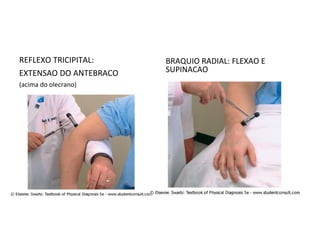 REFLEXO TRICIPITAL:
EXTENSAO DO ANTEBRACO
(acima do olecrano)
BRAQUIO RADIAL: FLEXAO E
SUPINACAO
 