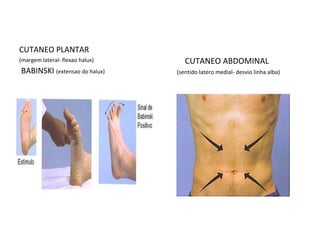 CUTANEO PLANTAR
(margem lateral- flexao halux)
BABINSKI (extensao do halux)
CUTANEO ABDOMINAL
(sentido latero medial- desvio linha alba)
 