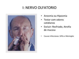 I: NERVO OLFATORIO
• Anosmia ou Hiposmia
• Testar com odores
cotidianos
• Excluir: Resfriado, Atrofia
de mucosa
• Causas Infecciosas: Sifilis e Meningite
 
