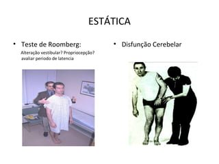 ESTÁTICA
• Teste de Roomberg:
Alteração vestibular? Propriocepção?
avaliar periodo de latencia
• Disfunção Cerebelar
 