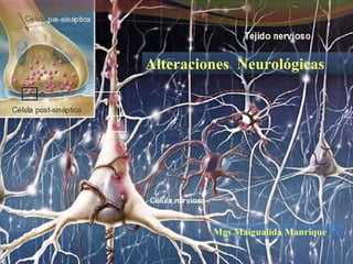 Alteraciones  Neurológicas Mgs.Maigualida Manrique 