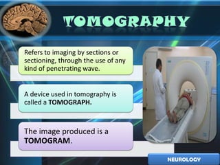Refers to imaging by sections or
sectioning, through the use of any
kind of penetrating wave.


A device used in tomography is
called a TOMOGRAPH.



The image produced is a
TOMOGRAM.

                                     NEUROLOGY
 
