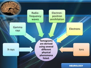 Radio-          Electron-
            frequency         positron
              waves          annihilation

    Gamma
                                            Electrons
     rays


                    Tomograms
                    are derived
                   using several
X-rays               different                      Ions
                      physical
                   phenomena
                       listed.

                                            NEUROLOGY
 