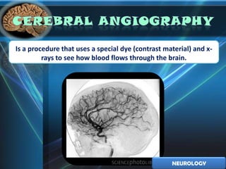 Is a procedure that uses a special dye (contrast material) and x-
         rays to see how blood flows through the brain.




                                                   NEUROLOGY
 