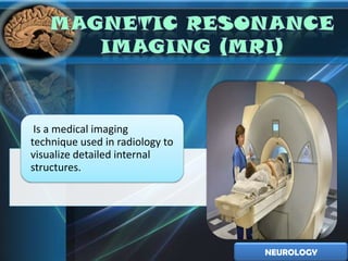 Is a medical imaging
technique used in radiology to
visualize detailed internal
structures.




                                 NEUROLOGY
 