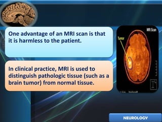 One advantage of an MRI scan is that
it is harmless to the patient.



In clinical practice, MRI is used to
distinguish pathologic tissue (such as a
brain tumor) from normal tissue.




                                           NEUROLOGY
 
