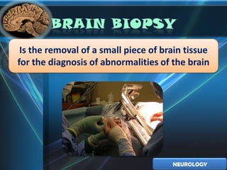 Is the removal of a small piece of brain tissue
for the diagnosis of abnormalities of the brain




                                      NEUROLOGY
 