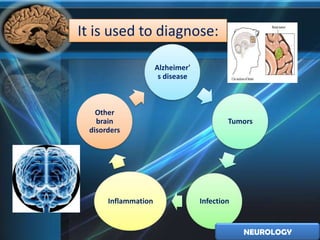 It is used to diagnose:

                     Alzheimer'
                      s disease



   Other
   brain                                  Tumors
 disorders




      Inflammation                Infection


                                              NEUROLOGY
 