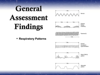 General
Assessment
 Findings
  Respiratory Patterns
 
