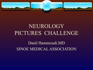 NEUROLOGY PICTURES  CHALLENGE Danil Hammoudi.MD SINOE MEDICAL ASSOCIATION 