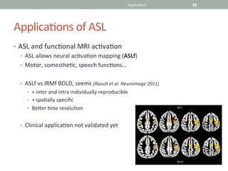 Neurology advanced asl jy gauvrit | PDF