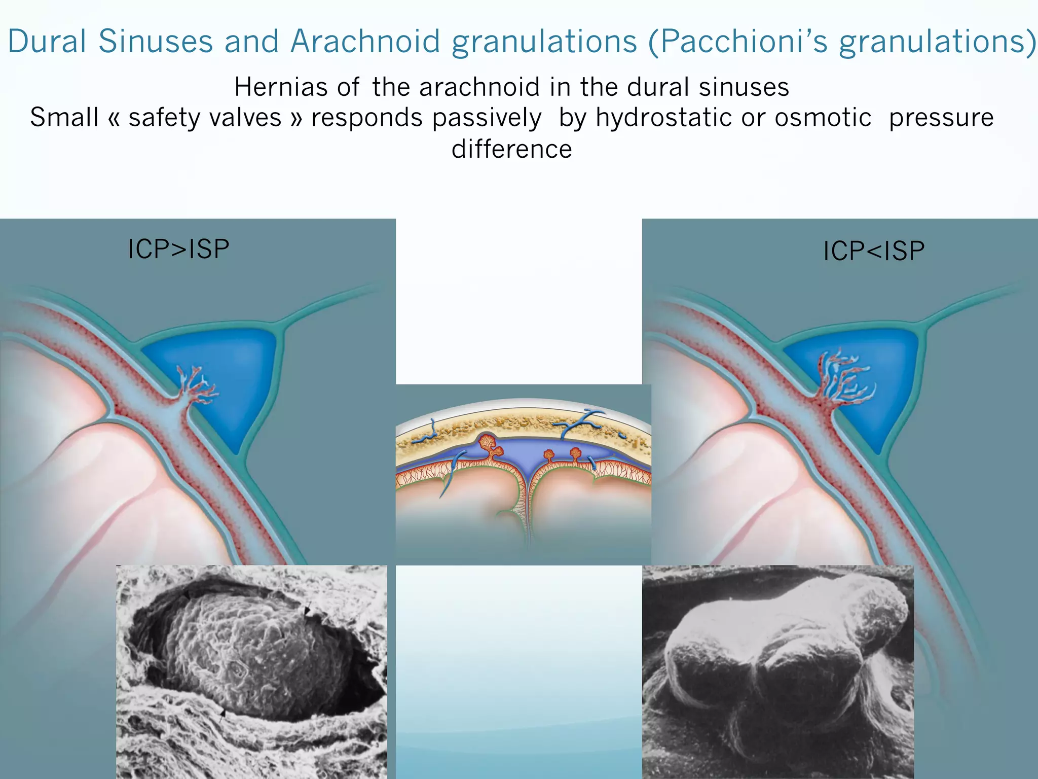 Dural Sinuses and Arachnoid granulations (Pacchioni’s granulations)
Hernias of the arachnoid in the dural sinuses
Small « safety valves » responds passively by hydrostatic or osmotic pressure
difference

ICP>ISP

ICP<ISP

 