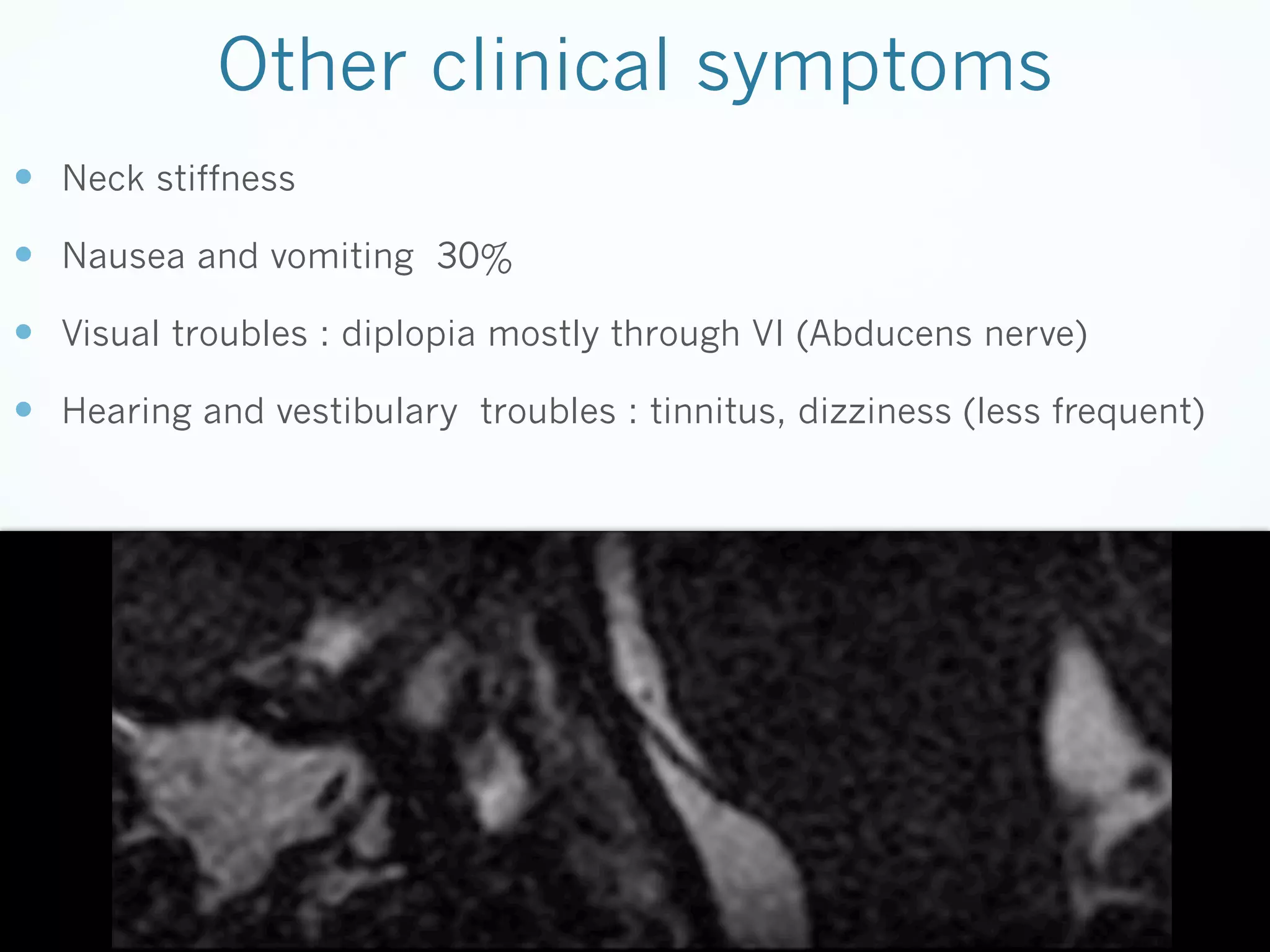 Other clinical symptoms
—  Neck stiffness
—  Nausea and vomiting 30%
—  Visual troubles : diplopia mostly through VI (Abducens nerve)
—  Hearing and vestibulary troubles : tinnitus, dizziness (less frequent)

 