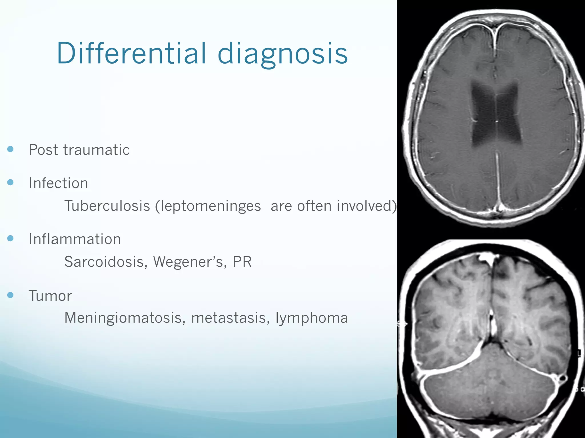 Differential diagnosis
—  Post traumatic
—  Infection
Tuberculosis (leptomeninges are often involved)

—  Inflammation
Sarcoidosis, Wegener’s, PR

—  Tumor
Meningiomatosis, metastasis, lymphoma

 