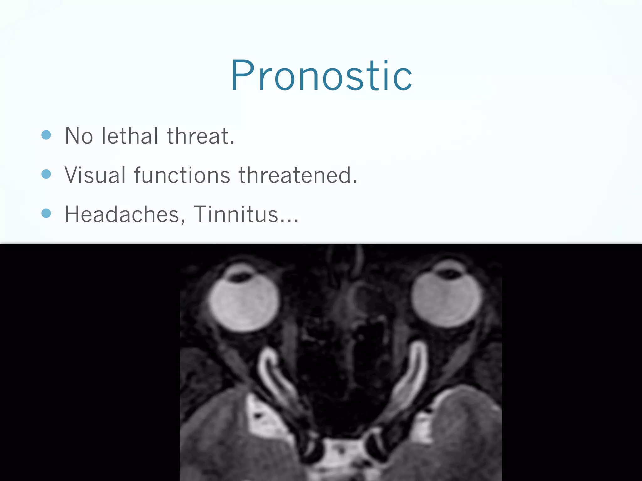 Pronostic
—  No lethal threat.
—  Visual functions threatened.
—  Headaches, Tinnitus…

 