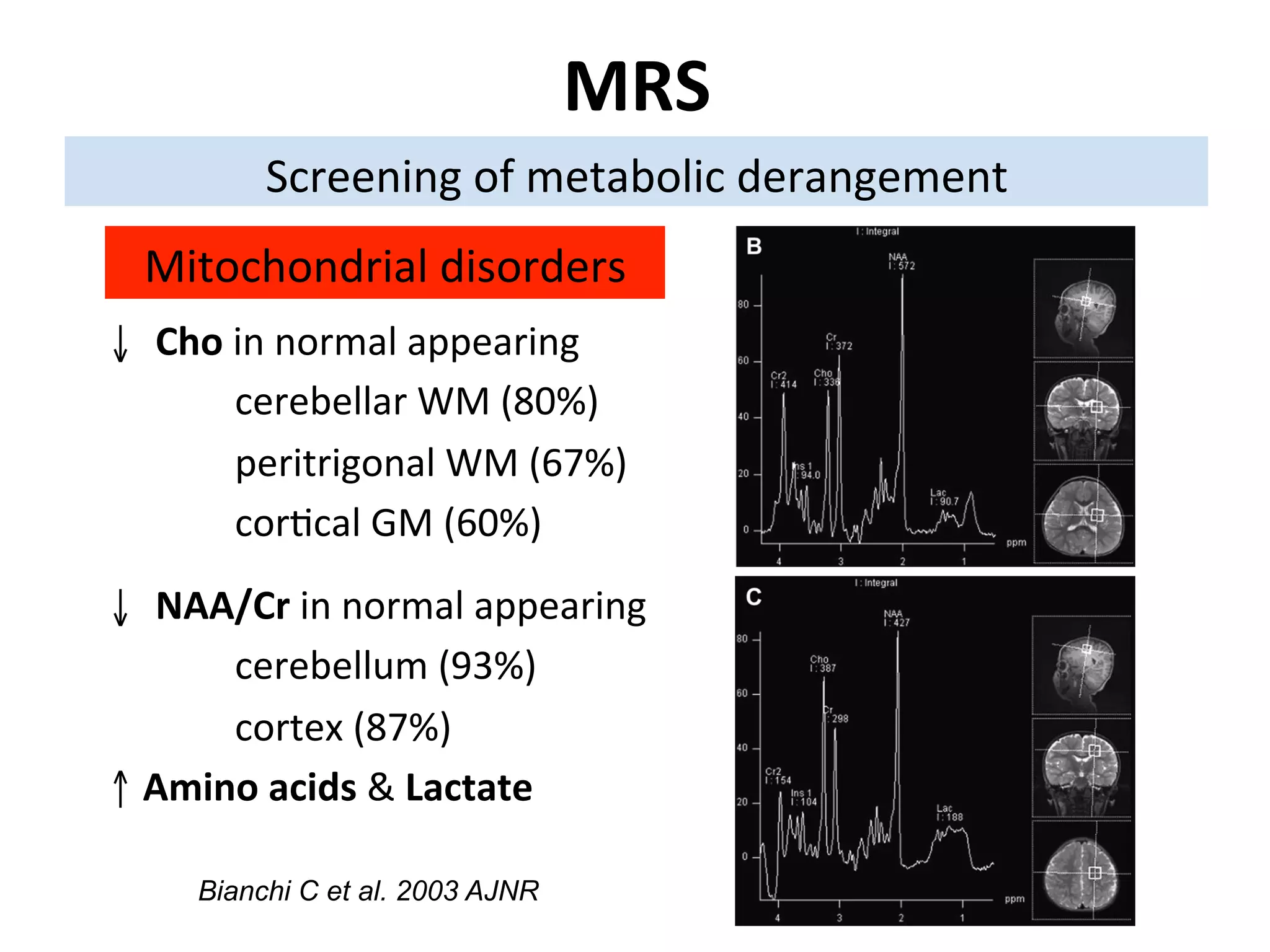 Neurology advanced mr imaging in epilepsy v lai | PDF