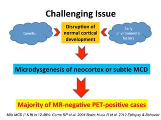 Neurology advanced mr imaging in epilepsy v lai | PDF