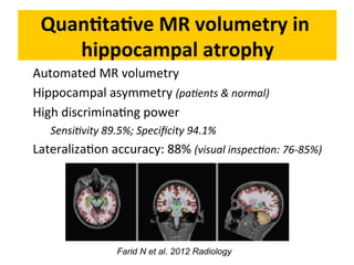 Neurology advanced mr imaging in epilepsy v lai | PDF