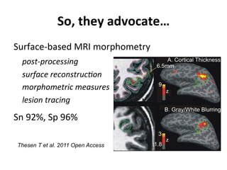 Neurology advanced mr imaging in epilepsy v lai | PDF