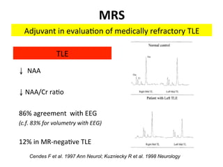 Neurology advanced mr imaging in epilepsy v lai | PDF
