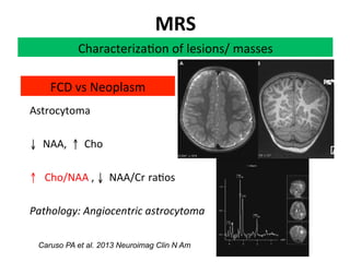 Neurology advanced mr imaging in epilepsy v lai | PDF