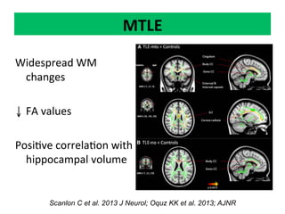 Neurology advanced mr imaging in epilepsy v lai | PDF