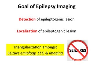Neurology advanced mr imaging in epilepsy v lai | PDF