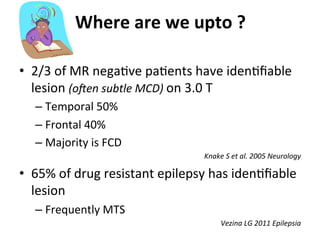 Neurology advanced mr imaging in epilepsy v lai | PDF