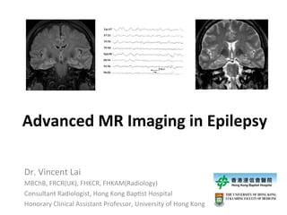 Advanced	
  MR	
  Imaging	
  in	
  Epilepsy
Dr.	
  Vincent	
  Lai	
  
MBChB,	
  FRCR(UK),	
  FHKCR,	
  FHKAM(Radiology)	
  
Consultant	
  Radiologist,	
  Hong	
  Kong	
  BapBst	
  Hospital	
  
Honorary	
  Clinical	
  Assistant	
  Professor,	
  University	
  of	
  Hong	
  Kong

 