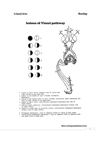 NeurologyIn Capsule Series
Www.InCapsuleSeries.Com
6767
 