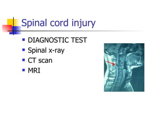 Spinal cord injury DIAGNOSTIC TEST Spinal x-ray CT scan MRI 
