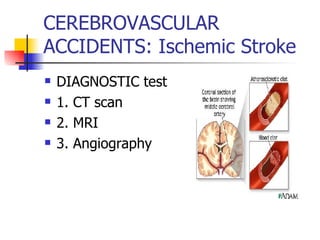 CEREBROVASCULAR ACCIDENTS: Ischemic Stroke DIAGNOSTIC test 1. CT scan 2. MRI 3. Angiography 